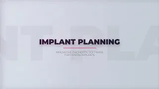 R2GATE Implant planning