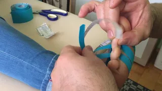 How to Apply Kinesiology Tape for Morton's Neuroma