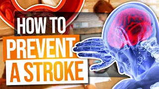 Do You Know What Causes Stroke? | Prevent Stroke From Happening