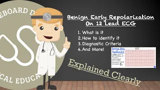 Benign Early Repolarization On Actual 12 Lead ECG - Identifying, Diagnostic Criteria, And More!