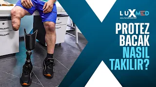 Protez Bacak Nasıl Takılır ? l Luxmed Protez