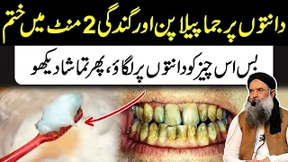 How To Clean Dirty Teeth In 2 Mint At Home | Best Way To Clean Dirty Teeth At Home Dr Sharafat Ali