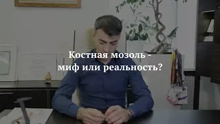 Костная мозоль после ринопластики: мифы или правда?