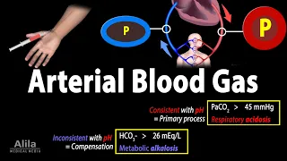 Arterial Blood Gas (ABG) Test, Animation