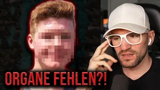 Seine Organe fehlen? - Der Fall Mike Mansholt (True Crime Reaction)