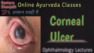 Corneal ulcer by Geetaru