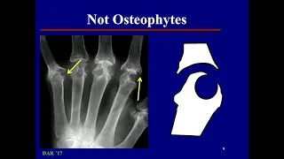 imaging in Osteoarthritis