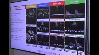 Venous excess ultrasound score (VExUS)