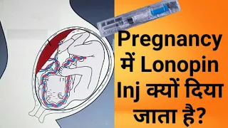 Lonopin injection in pregnancy