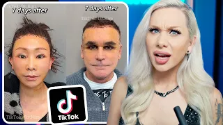 We need to talk about Tiktok Plastic Surgery