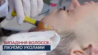 Випадіння волосся - лікуємо уколами