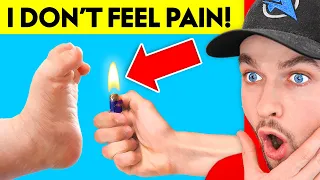 I Can’t Feel PAIN! (True Story Animation)