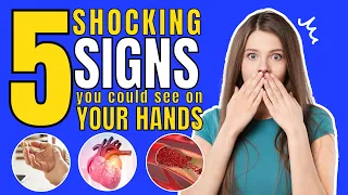Top 5 Heart Disease Symptoms Your Hands UNCOVER