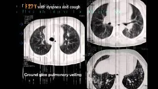 CT chest- Diffuse lung disease (In Arabic)