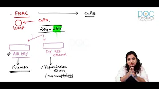 Neoplasia Diagnosis part 2 - FNAC | General Pathology | DocTutorials