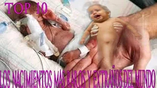 TOP10 Los Nacimientos Mas Raros y Extraños Del Mundo