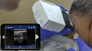 Ultrasound Guided Nerve Block by Dr. David Rosenblum | Clarius for Interventional Pain Management