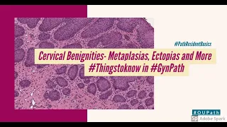 Cervical Benignities- #GynPath #BasicsforResidents