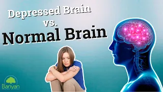 Depressed Brain vs Normal Brain