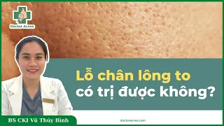 DOCTOR ACNES - LỖ CHÂN LÔNG TO CÓ ĐIỀU TRỊ ĐƯỢC KHÔNG?