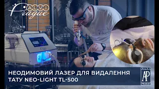 Неодимовий лазер для видалення тату Neo-Light TL-500