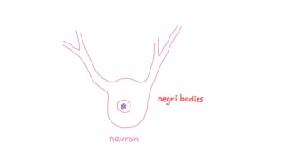 Rabies - Pathogenesis, Clinical Presentation, and Diagnosis