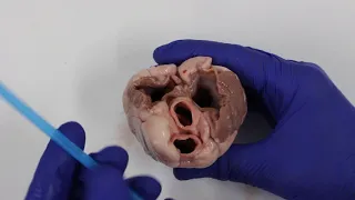 Lamb's heart dissection