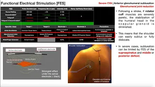 Functional Electrical Stimulation [FES] | Theory, Use, & Parameters