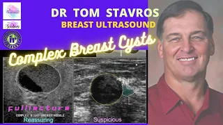 Breast cysts that aren't simple | DR Tom Stavros | Breast Ultrasound | BIRADS II lesions