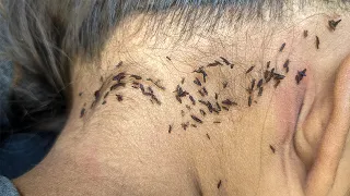 Remove hundred lice from black hair - Pick out all thousand lice from her long hair