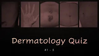 Dermatology Quiz #1 - 5