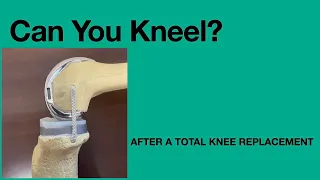 Kneeling after Total Knee Replacement