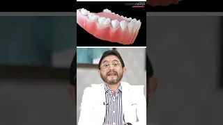 CARIES CERVICAL #dentista