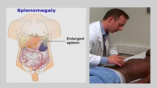 Percussion of the abdomen - Examination of the gastrointestinal system