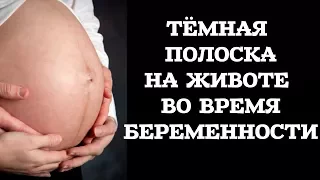 ТЁМНАЯ ПОЛОСКА НА ЖИВОТЕ ВО ВРЕМЯ БЕРЕМЕННОСТИ / Почему появилась темная полоска на животе?