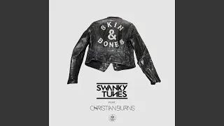 Skin & Bones (Radio Edit)