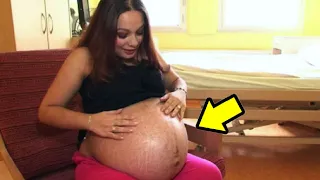 O que tinha NA BARRIGA DESSA MULHER deixou os médicos CHOCADOS!