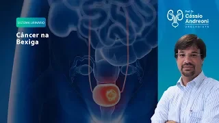 Câncer de Bexiga: causa, sintoma e tratamento | Dr. Cassio Andreoni CRM 78.546
