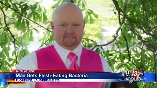 Man Gets Flesh-Eating Bacteria