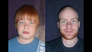 Photo A Day For 15 Years (Age 13 to 28)