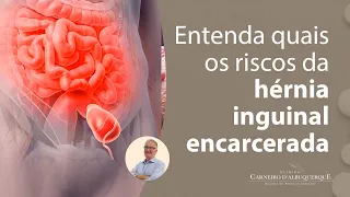 Entenda quais os riscos da hérnia inguinal encarcerada | Prof. Dr. Luiz Carneiro CRM 22761