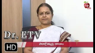 Neuropathy | Dr ETV | 27th July 2019 | ETV Life