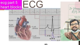 MASTER ECG/EKG INTERPRETATION: A Systematic Approach for 12 Lead ECG/EKGs#ecgbasics#ecg#ecgmadeeasy