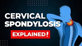 Cervical Spondylosis Explained #neckpain #arthritis #rheumatoidarthritis #jointpain