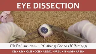 Eye Dissection - GCSE/A Level/IB Biology