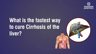 What is the fastest way to cure Cirrhosis of the liver?