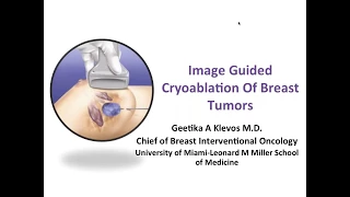 SIR-RFS Webinar (05/07/2017): Image-Guided Cryoablation of Breast Tumors