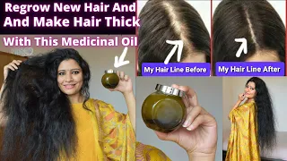 Grow Your Lost Hair With This Homemade Medicinal Oil and Make Your Hair Thick,Dense, Strong, Long