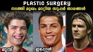 Plastic Surgery നടത്തി മുഖം മിനുക്കിയവർ 😲😳 | Cristiano റൊണാൾഡോ | Cr7 soccergram