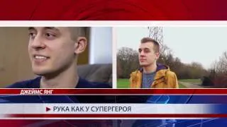 Рука как у супергероя